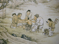 中国の古い治療イメージ